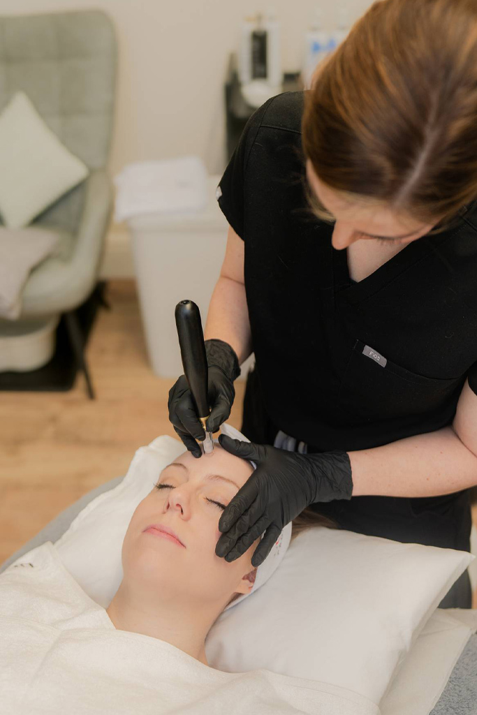 Bio-Revitalizing Chemical Peel & Microneedling Combined